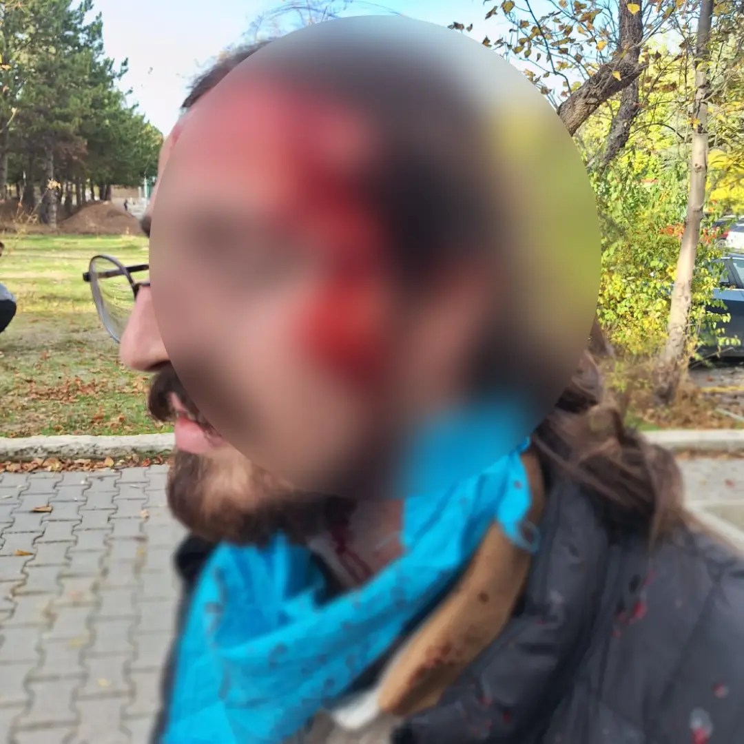 Hacettepe'de palalı saldırı: Saldırganlar kampüse nasıl girdi?