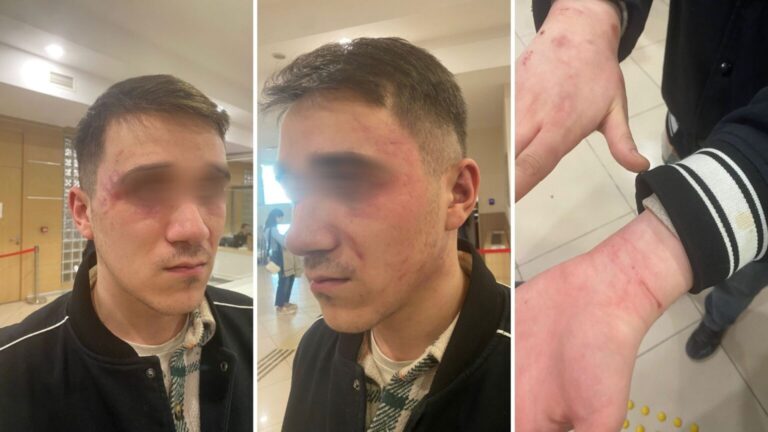 Kadıköy'de karakolda işkence