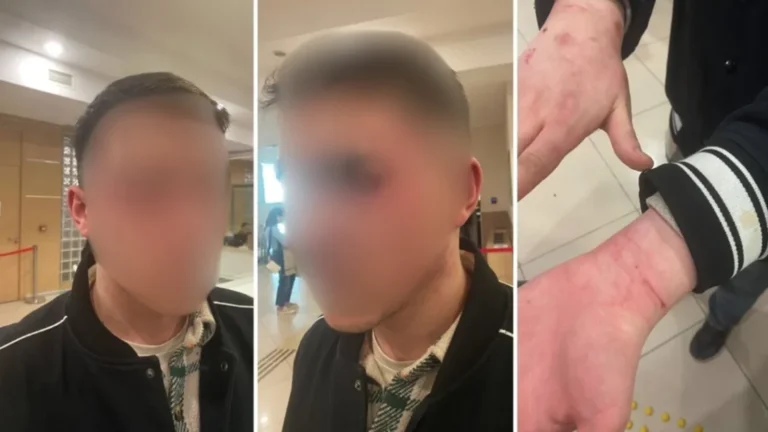 Turkish authorities launch probe into police torture allegations