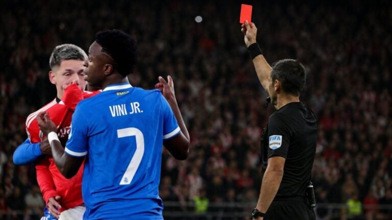 Tartışırken ağzını kapatan